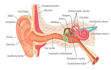 somatic tinnitus; neck exercises for tinnitus; somatic tinnitus treatment plan; objective tinnitus